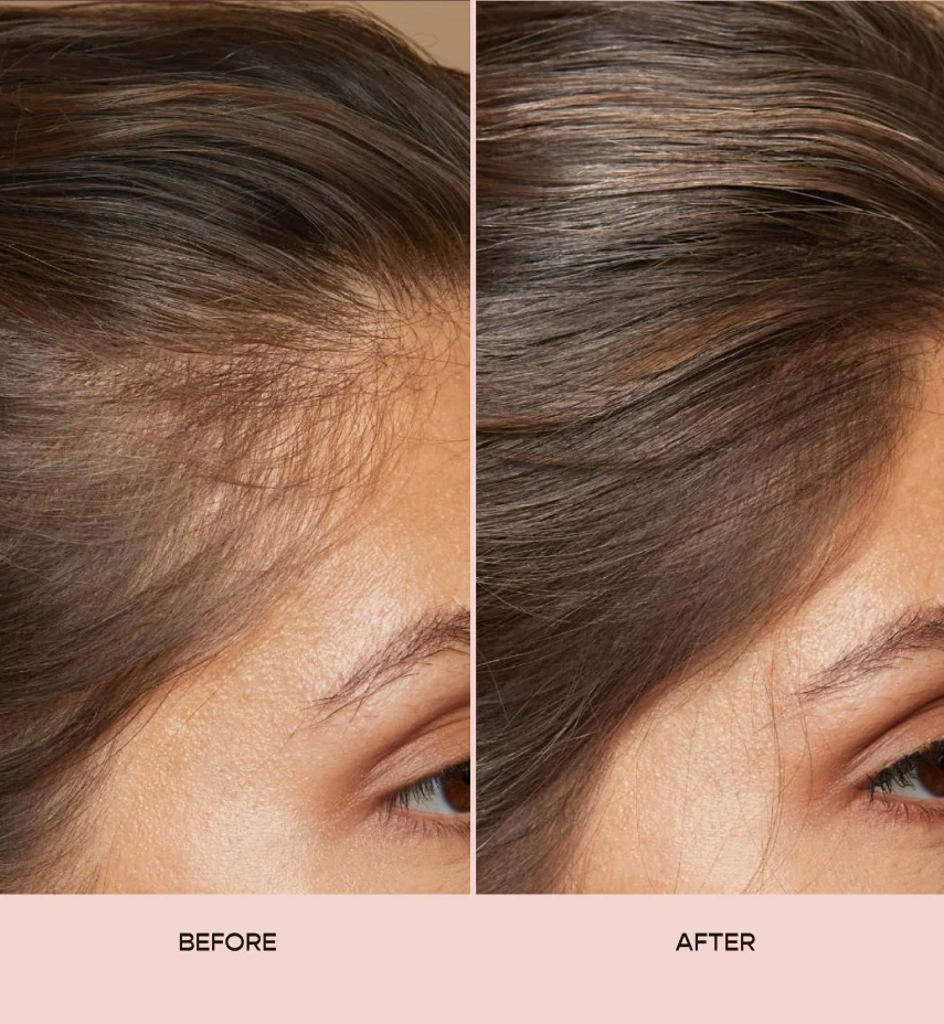 Prezia's Hair Growth Serum