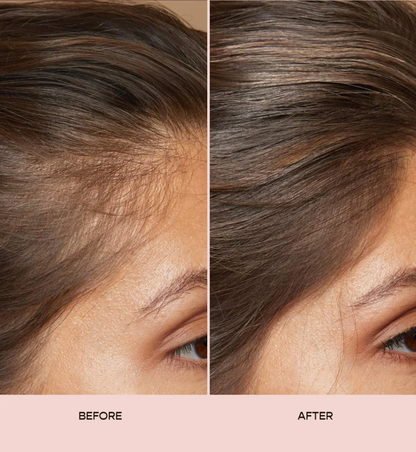 Prezia's Hair Growth Serum